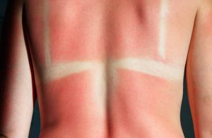 7 errores de belleza que cometemos en la playa