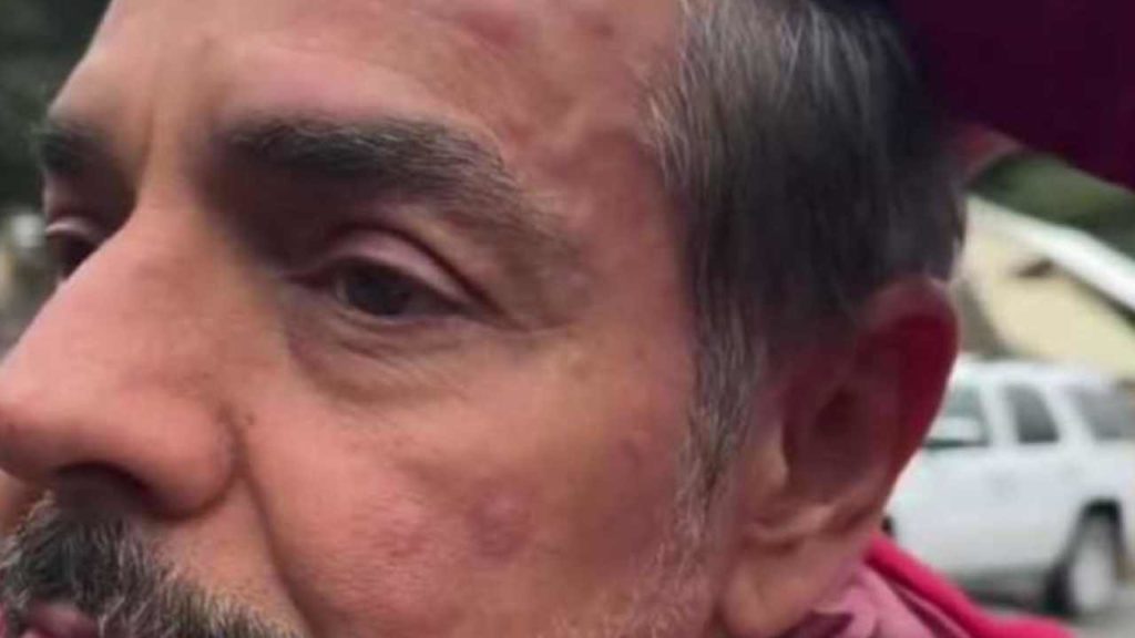 ¡Eugenio Derbez preocupa a su fans tras aparecer con el rostro hinchado!