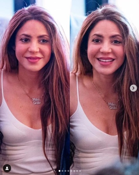 Shakira preocupa a sus fans: ¿Exceso de retoques estéticos?